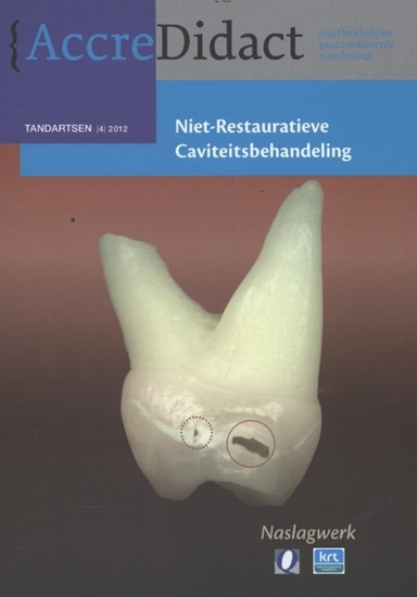 Afbeelding van AccreDidact Niet-restauratieve caviteitsbehandeling