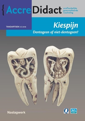 Afbeeldingen van AccreDidact Kiespijn, dentogeen of niet-dentogeen?