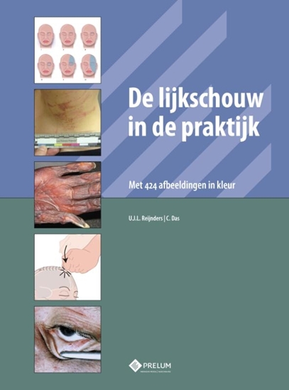 Afbeelding van De lijkschouw in de praktijk