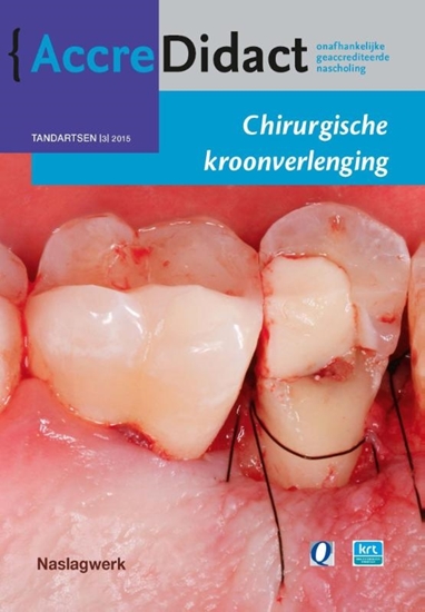 Afbeelding van AccreDidact Chirurgische kroonverlenging