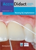 Afbeelding van AccreDidact Nazorg bij implantaten Mondhygiënist 2020-1