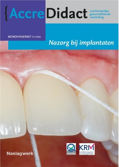 Afbeelding van AccreDidact Nazorg bij implantaten Mondhygiënist 2020-1