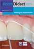 Afbeelding van AccreDidact Nazorg bij implantaten Mondhygiënist 2020-1
