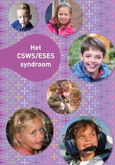 Afbeelding van Het CSWS/ESES syndroom