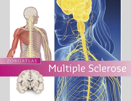 Afbeelding van Zorgatlas Multiple Sclerose