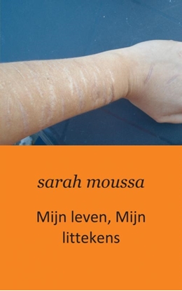 Afbeeldingen van Mijn leven, mijn littekens
