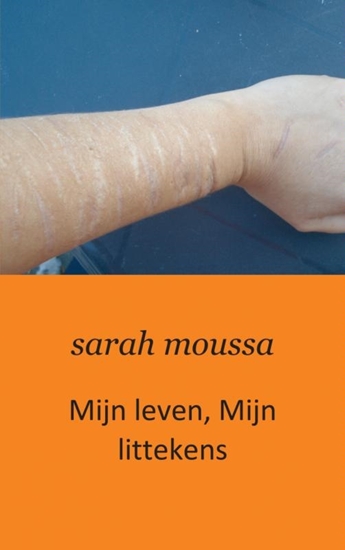Afbeelding van Mijn leven, mijn littekens