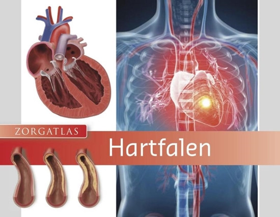 Afbeelding van Zorgatlas Hartfalen