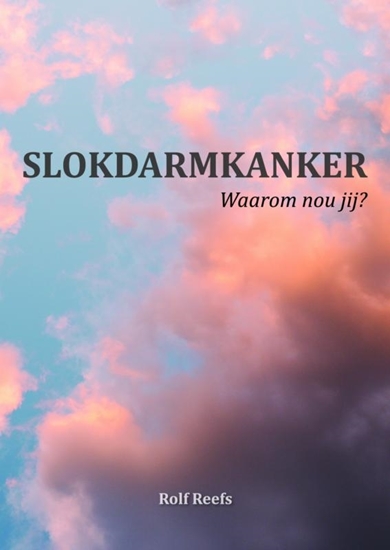 Afbeelding van Slokdarmkanker