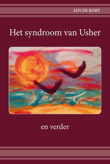 Afbeelding van Het syndroom van Usher