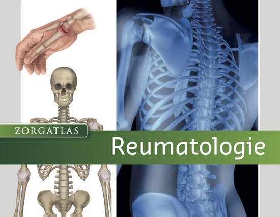 Afbeelding van Reumatologie