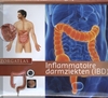 Afbeelding van Zorgatlas Inflammatoire darmziekten (IBD)