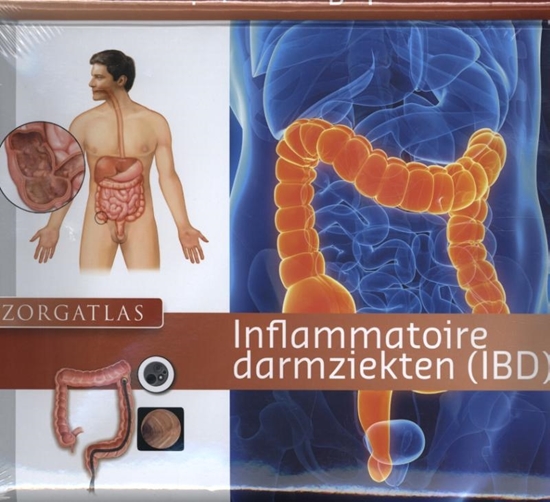 Afbeelding van Zorgatlas Inflammatoire darmziekten (IBD)