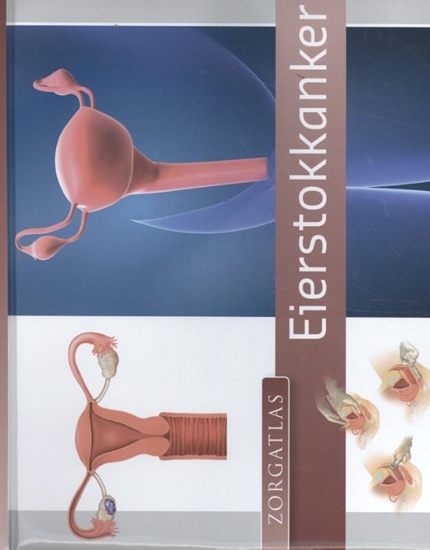 Afbeelding van Zorgatlas Eierstokkanker