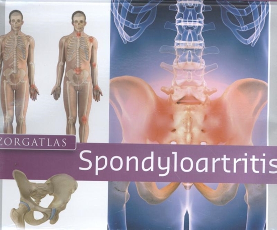Afbeelding van Zorgatlas Spondyloartritis