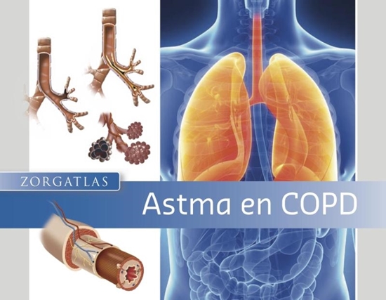 Afbeelding van Zorgatlas Astma en COPD