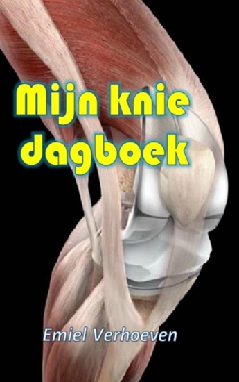 Afbeelding van Mijn knie dagboek