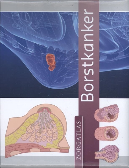 Afbeelding van Zorgatlas Borstkanker