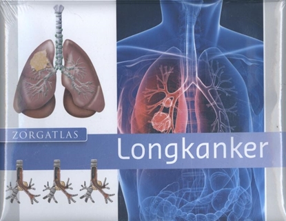 Afbeeldingen van Zorgatlas Longkanker