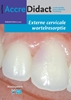 Afbeelding van AccreDidact Externe cervicale wortelresorptie