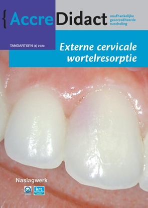 Afbeeldingen van AccreDidact Externe cervicale wortelresorptie