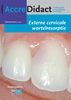 Afbeelding van AccreDidact Externe cervicale wortelresorptie