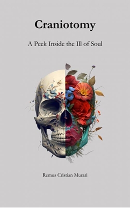 Afbeeldingen van Craniotomy