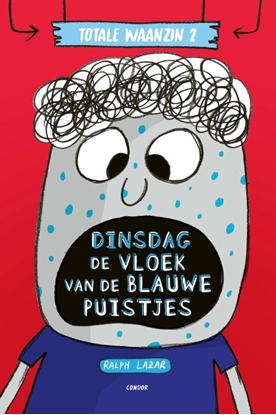 Afbeeldingen van Totale waanzin Dinsdag: De vloek van de blauwe puistjes