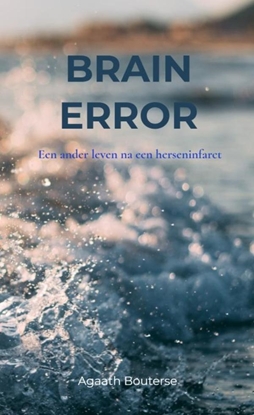 Afbeeldingen van Brain Error