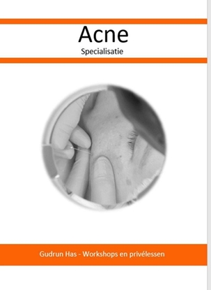Afbeeldingen van Acne