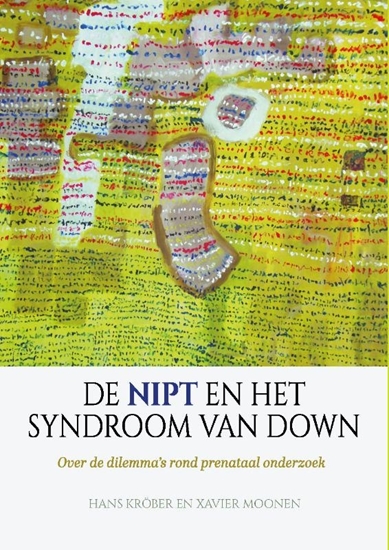 Afbeelding van De NIPT en het syndroom van Down