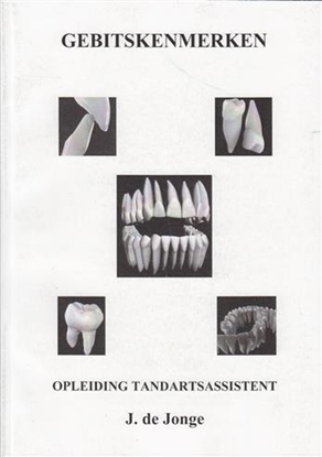 Afbeeldingen van Gebitskenmerken