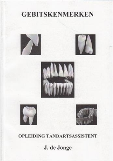 Afbeelding van Gebitskenmerken