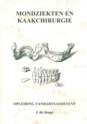 Afbeeldingen van Mondziekten en kaakchirurgie