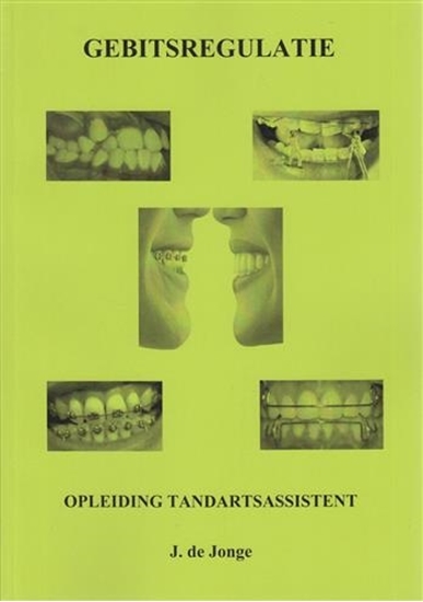 Afbeelding van Gebitsregulatie