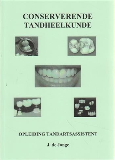Afbeelding van Conserverende Tandheelkunde