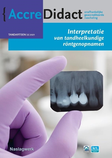 Afbeelding van AccreDidact Interpretatie van tandheelkundige röntgenopnamen