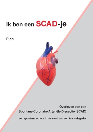 Afbeelding van IkbeneenSCAD-je