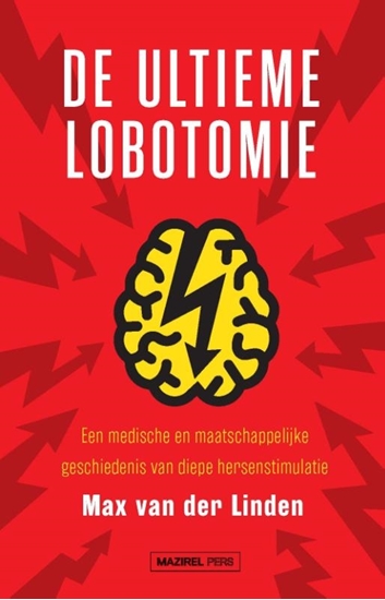 Afbeelding van De ultieme lobotomie
