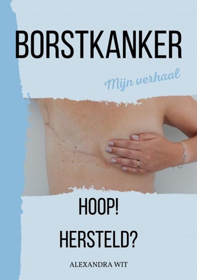 Afbeelding van BORSTKANKER