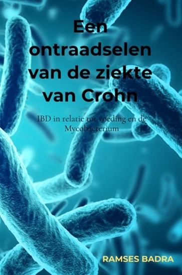 Afbeelding van Een ontraadselen van de ziekte van Crohn