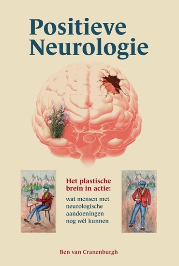 Afbeelding van Positieve neurologie