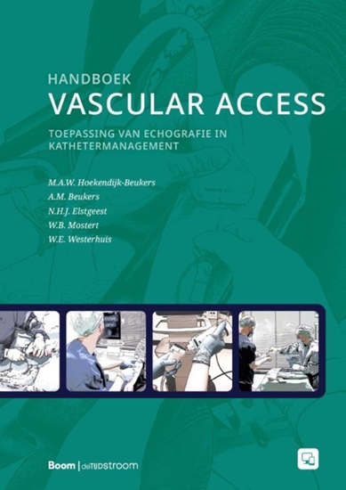 Afbeelding van Handboek vascular access
