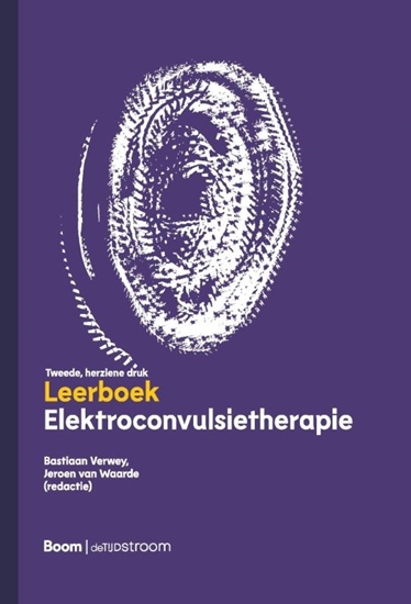 Afbeelding van Elektroconvulsietherapie