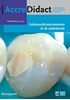 Afbeelding van AccreDidact Calciumsilicaatcementen in de endodontie
