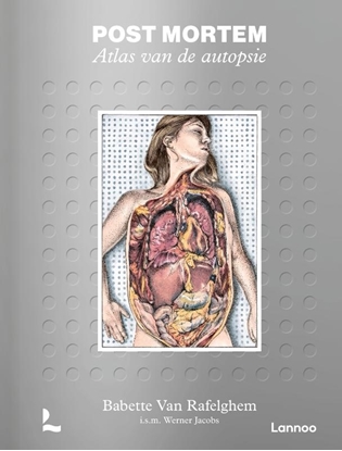 Afbeeldingen van Post mortem. Atlas van de autopsie