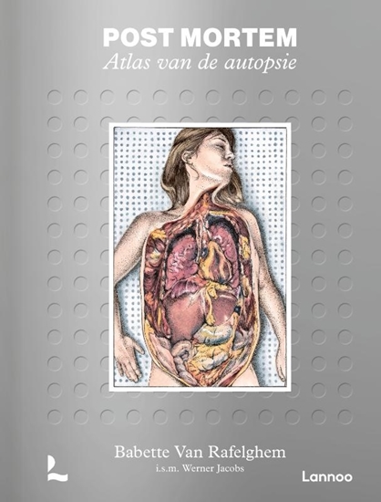 Afbeelding van Post mortem. Atlas van de autopsie