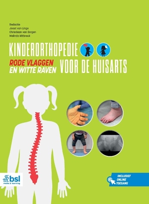 Afbeeldingen van Kinderorthopedie voor de huisarts