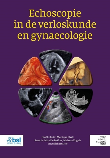 Afbeelding van Echoscopie in de verloskunde en gynaecologie