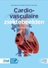 Afbeelding van Cardiovasculaire ziektebeelden